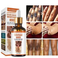 +2771 073 2372 Get Rid Of Tattoos And Dark Spots In Eringsboda Municipality in Sweden
